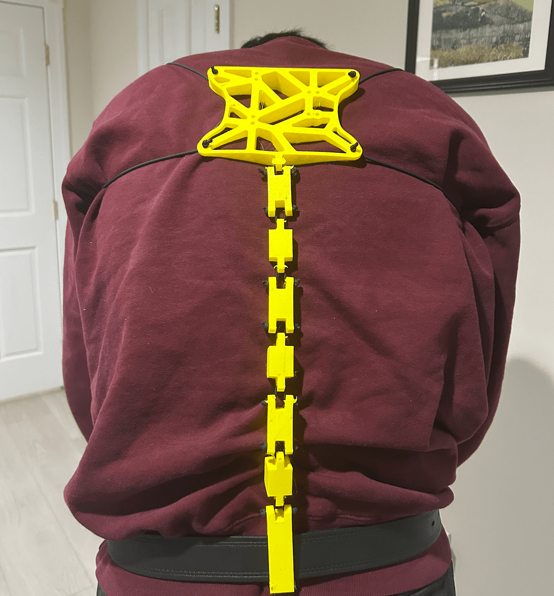 Backbrace | 2024