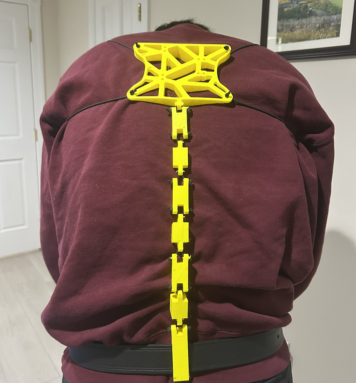 Backbrace | 2024